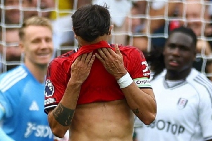 詹?。郝?lián)開局猛B費(fèi)丟點(diǎn)是轉(zhuǎn)折點(diǎn) 舍什科登場紅魔三叉戟聯(lián)系不多